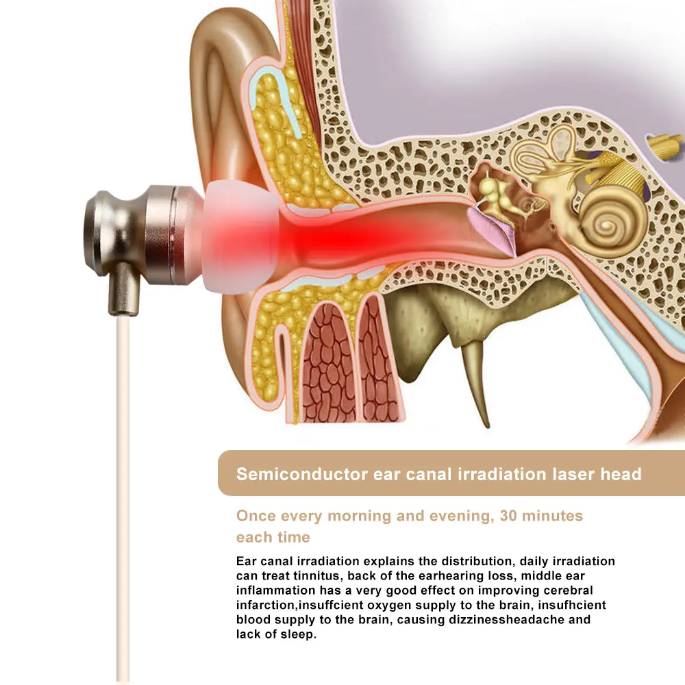 Tinnitus Ear Laser Irradiation Therapy Otitis Media 650nm RedLight Deafness Device Tinnitus Physiotherapy LLLT Ear Canal Earplug