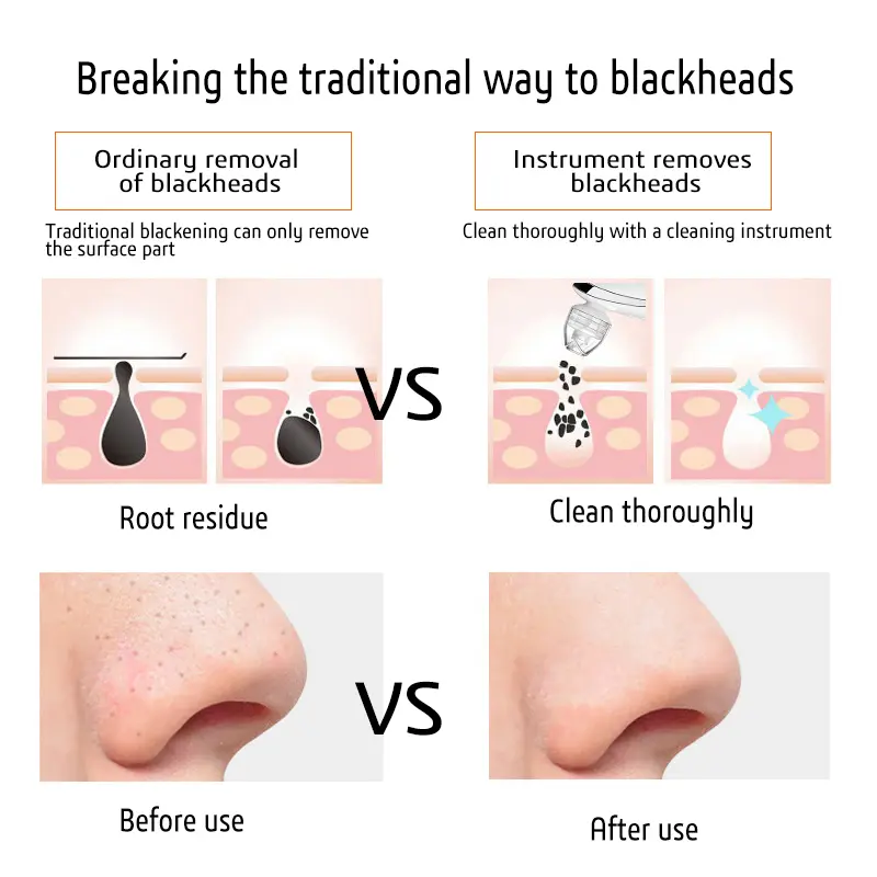 Diamond Microcrystal Facial Pore Cleaner Blackhead Remover Suction Vacuum Acne Remover LED Screen Display Facial Cleaner Machine