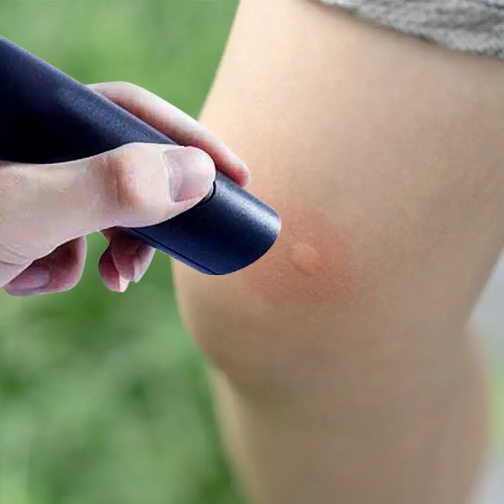Electronic Mosquito Bite Pen Anti-Itch Pen Anti-itch Stick Physical Itch Stop Pen Relief Burning Pain & Swelling for Summer