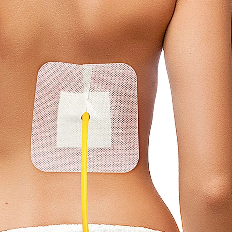 5/10Pcs Drainage Tube Sterile Applicator Peritoneal Dialysis Catheter Bile Duct Nephrostomy Gastric Tube With Hole Sticker Fixed