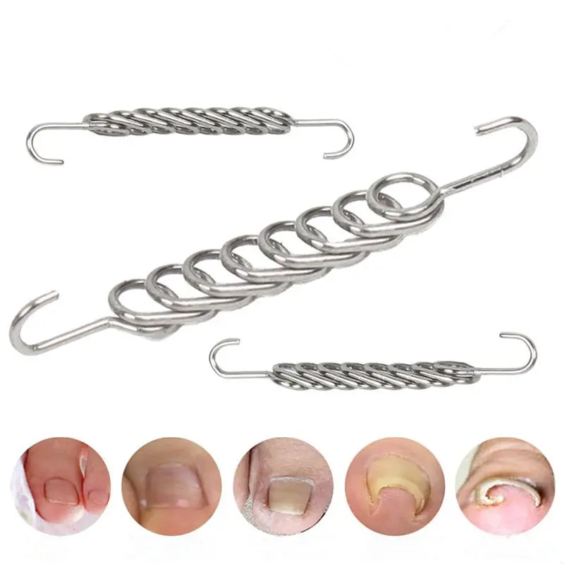 Ingrown Toenail Corrector Tools Pedicure Recover Embed Toe Nail Treatment Professional Ingrown Toenail Correction Foot CareTool