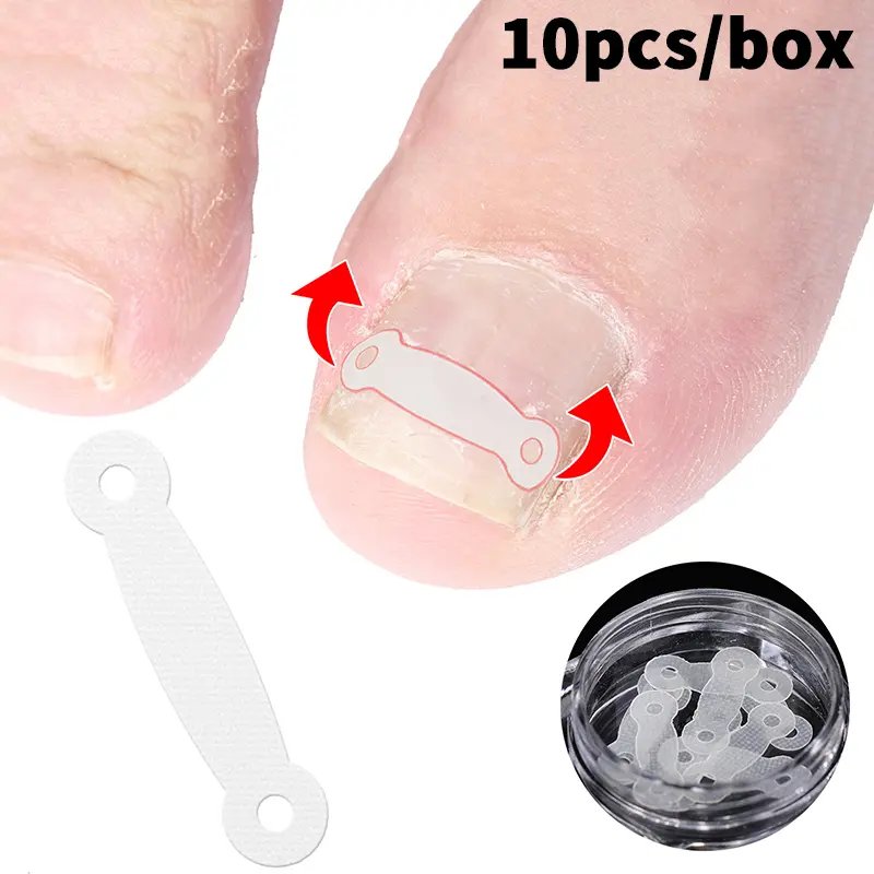 10PCS Ingrown Toe Nail Treatment Ingrown Toenail Correction Tool Elastic Patch Sticker Straightening Clip Brace Pedicure Tools