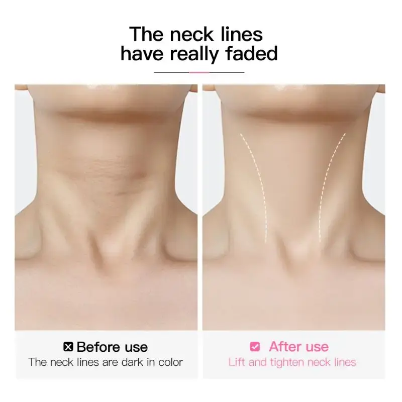10pcs Transparent Neck Lifting Patches Waterproof Elasticity Invisible Fading Neck Wrinkle Adhesive Stickers Face Lift Tape