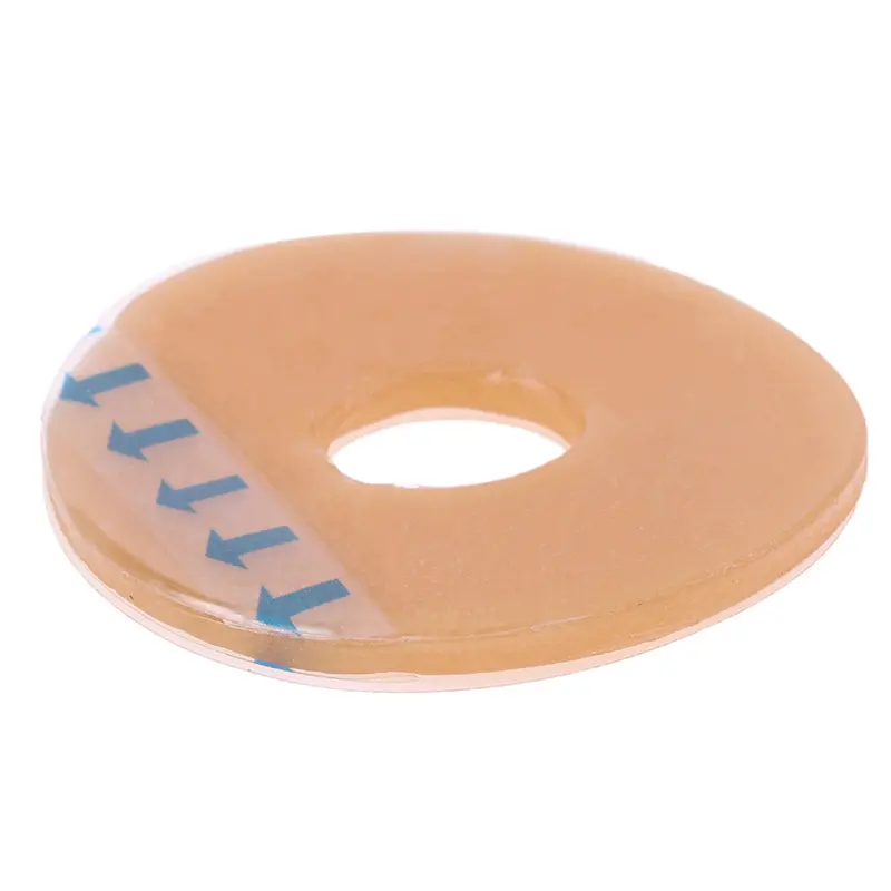1Pc Anti-Leakage Ring For Colostomy Bag Ostomy Paste Ring Baseplates Stoma Care Products To Protect Skin