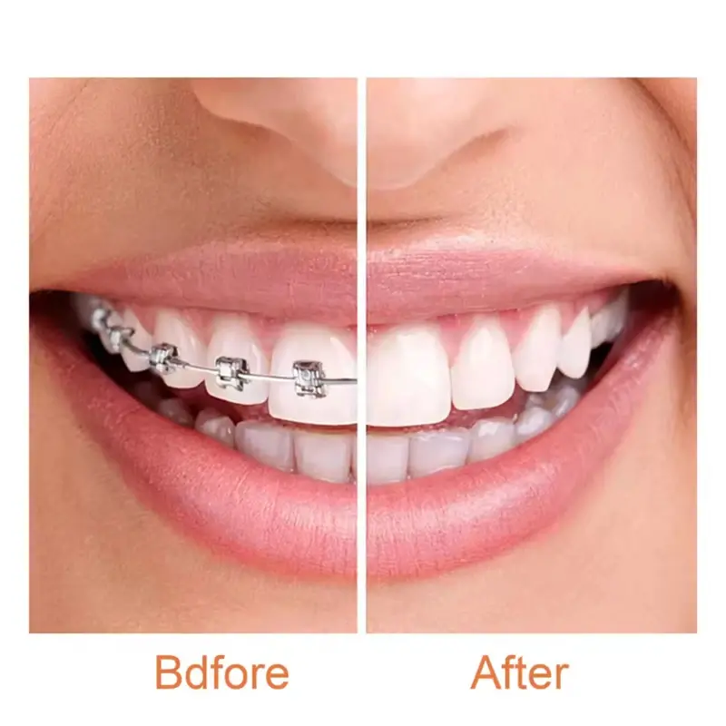 1PC Dental Chewies Bite Stick Glue Adult Glue Invisible Bite Braces Correction Flavourless For Dental Braces