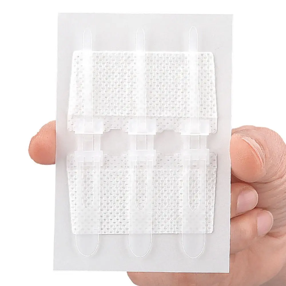 Wound Care Zip Sutures Bandaids Adhesive Emergency Without Stitches Emergency Wound Closures First Aid Laceration Closures
