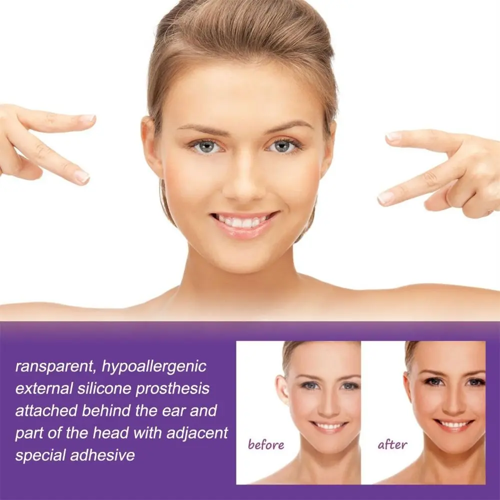 Ear Corrector Auricle Valgus Correction Waterproof Ear Stickers Transparent Silicone Orthotics  For All Ages