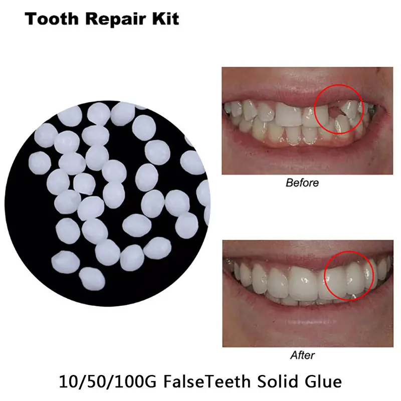 10/50/100g Dental Resin Shapeable Teeth Glue Temporary Filling Teeth Repair Makeup Dental Material Particles