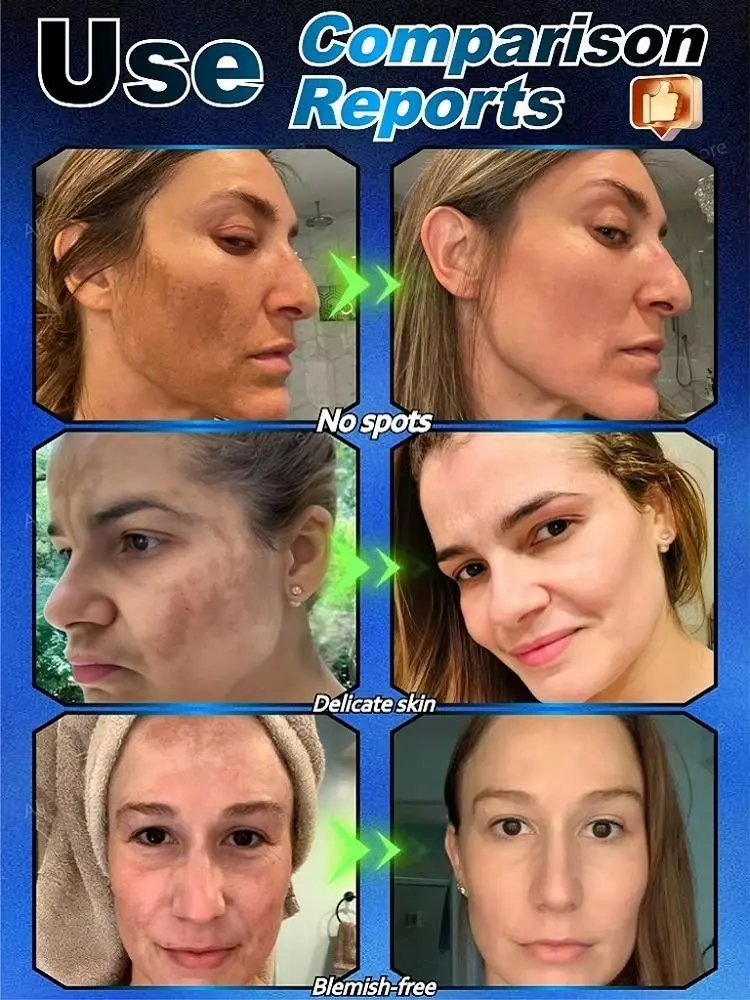 ¹⁰⁰% ˢᵃᶠᵉ ᵃⁿᵈ ᵉᶠᶠᵉᶜᵗⁱᵛᵉ  Regarding facial and body pigmentation, melasma, and pigmentation issues