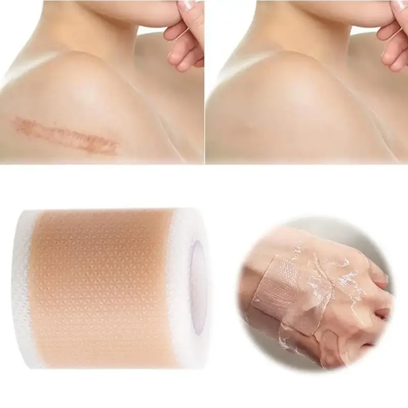 4X150CM Silicone Scar Patch Skin Repair Sheets Removal Self-Adhesive Stretch Mark Tape Therapy Patch Burn Acne Scar Skin Care