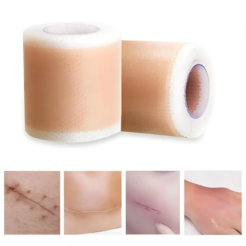 4X150CM Silicone Scar Patch Skin Repair Sheets Removal Self-Adhesive Stretch Mark Tape Therapy Patch Burn Acne Scar Skin Care