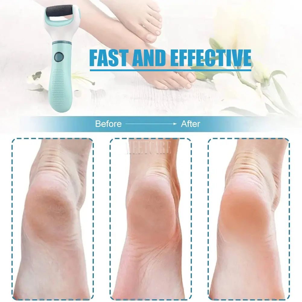 Wireless Foot Grinder USB Recharge Waterproof Portable Anti Callus Dead Skin Cracks Pedicure Tool Foot Care Hard Cracked Clean