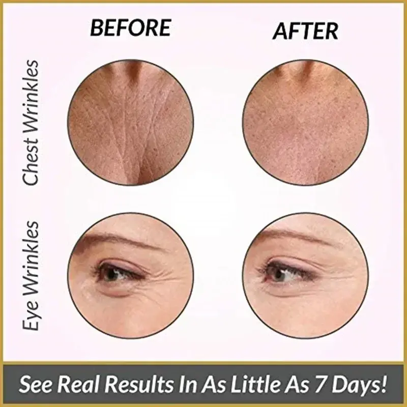 Reusable Silicone Wrinkle Removal Sticker Facial Lifting Strips Set Forehead Neck Line Remover Eye Patches Anti Aging Skin Pads