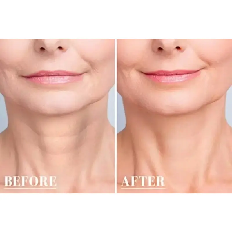 Reusable Silicone Wrinkle Removal Sticker Facial Lifting Strips Set Forehead Neck Line Remover Eye Patches Anti Aging Skin Pads