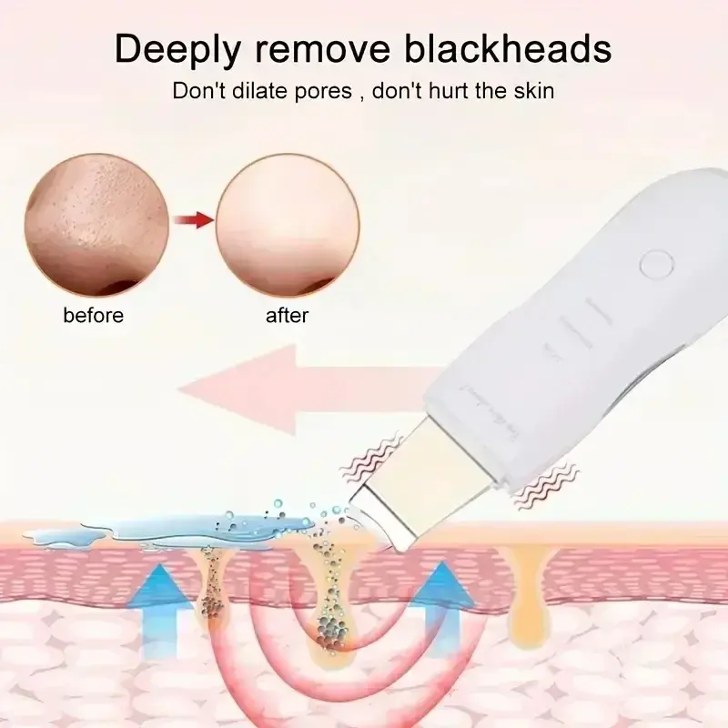 Deep Vibrate Skin Scrubber Facial Cleaner Tool Blackhead Remover & Peeling Massager Non Ultrasonic Spatula for Pore Cleansing