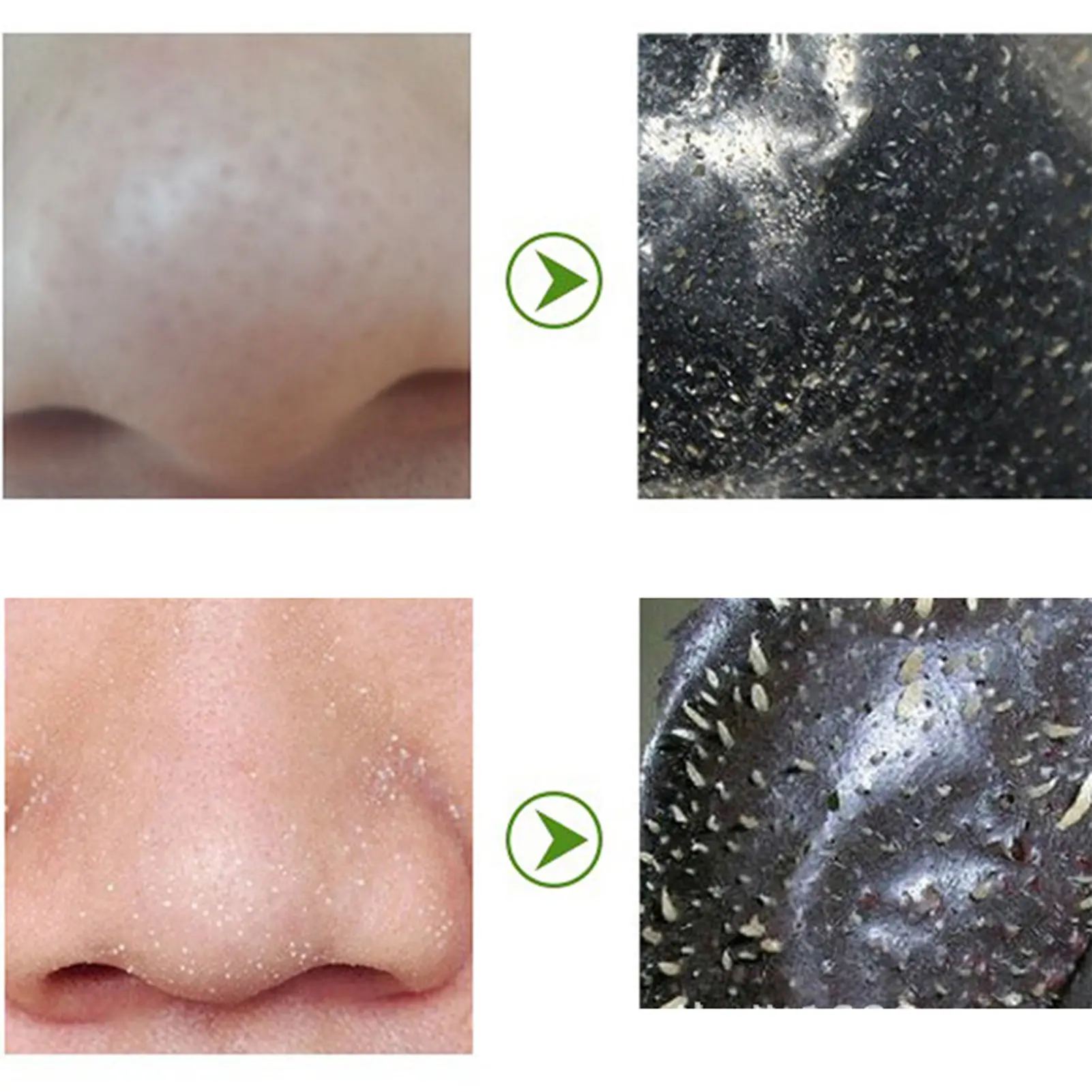 10pcs Nasal Stickers Black Head Nose Strips Deep Cleansing Pore Unclogging Pore Strips Black Head Remover